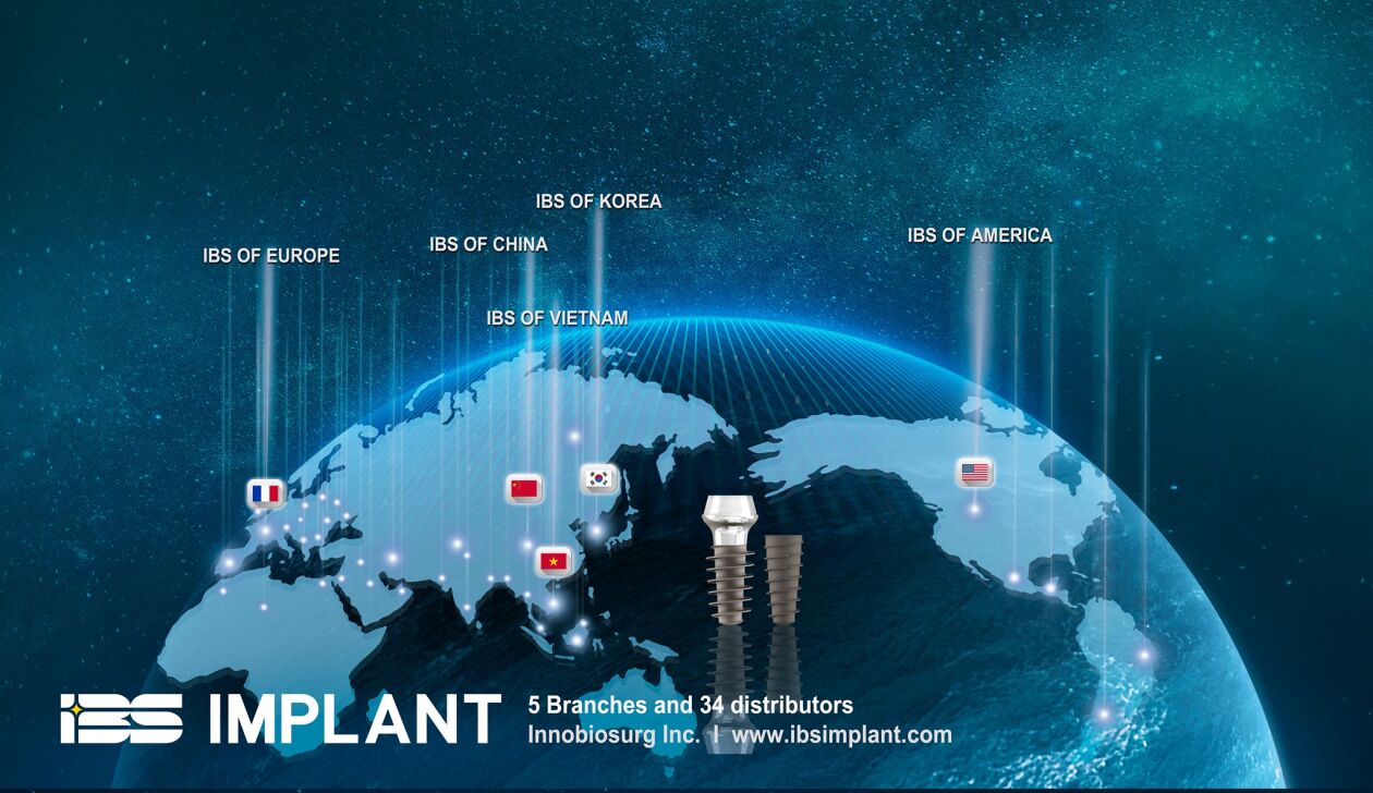 Cover image for IBS IMPLANT