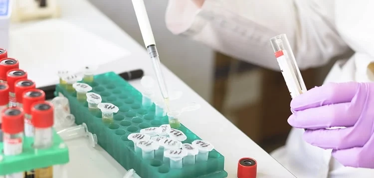 Top 10 dịch vụ xét nghiệm tại nhà trả kết quả online nhanh nhất